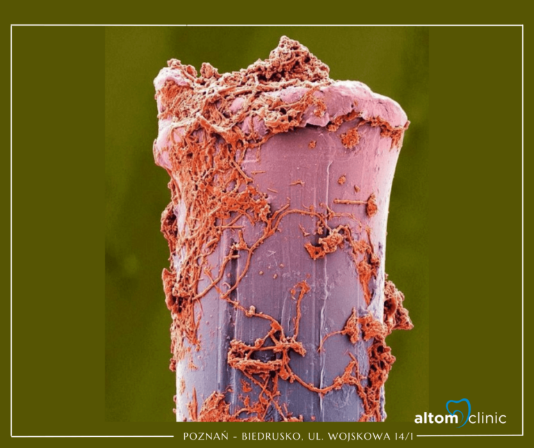 Jak często należy wymieniać szczoteczkę na nową?