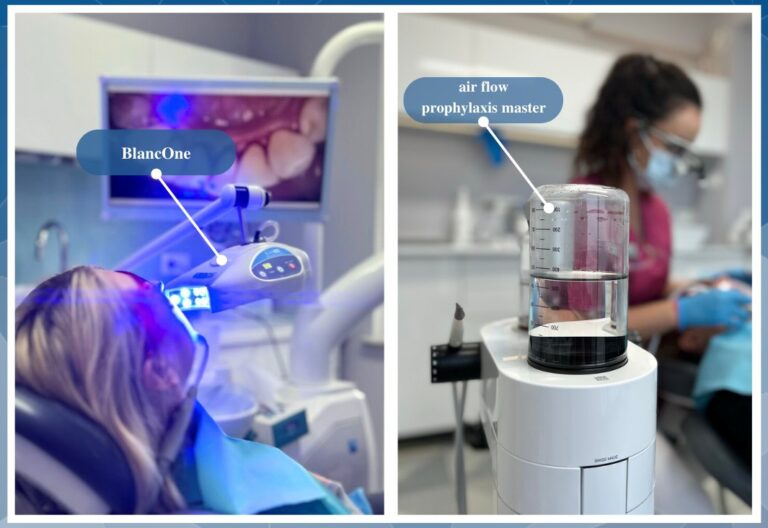 Odśwież swój uśmiech – wybielanie i czyszczenie na jednej wizycie