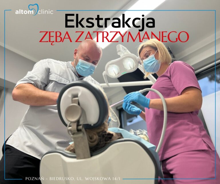 Ekstrakcja zęba zatrzymanego - co warto wiedzieć 2024