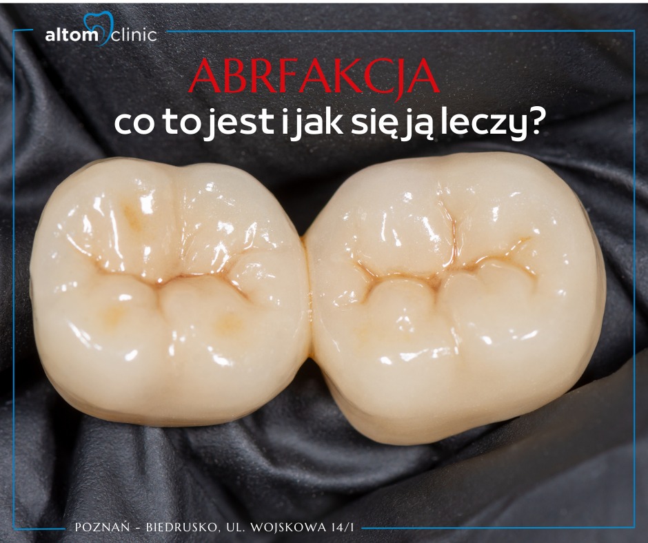 Abfrakcja - dlaczego jest niezbędna?