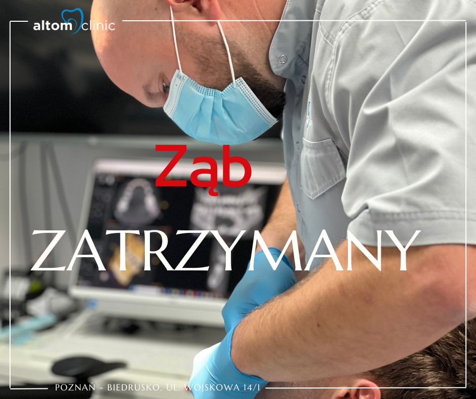 Ekstrakcja zęba zatrzymanego