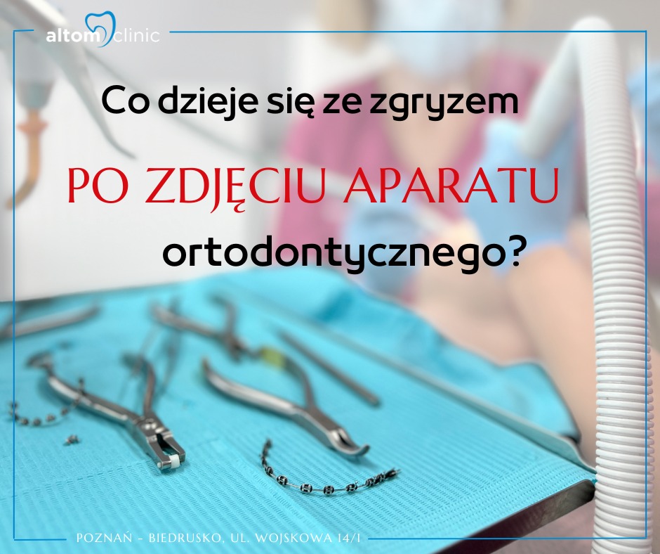 𝐂𝐨 𝐝𝐳𝐢𝐞𝐣𝐞 𝐬𝐢𝐞 𝐳𝐞 𝐳𝐠𝐫𝐲𝐳𝐞𝐦 𝐩𝐨 𝐳𝐝𝐣𝐞𝐜𝐢𝐮 𝐚𝐩𝐚𝐫𝐚𝐭𝐮 𝐨𝐫𝐭𝐨𝐝𝐨𝐧𝐭𝐲𝐜𝐳𝐧𝐞𝐠𝐨