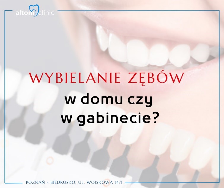 Wybielanie zębów w domu czy w gabinecie, którą metodę wybrać?