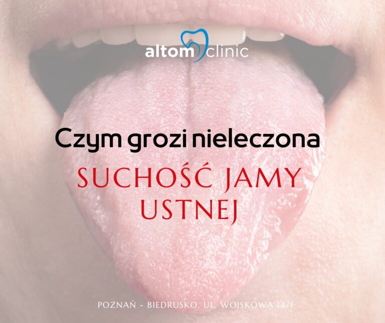Czym grozi nieleczona suchość jamy ustnej (kserostomia)?