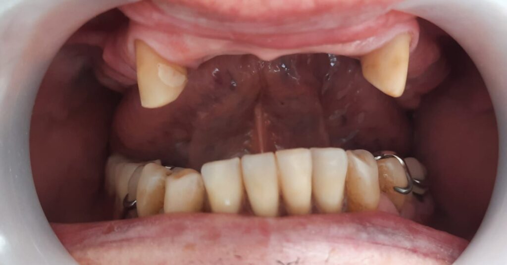 Nowy uśmiech, nowa pewność siebie