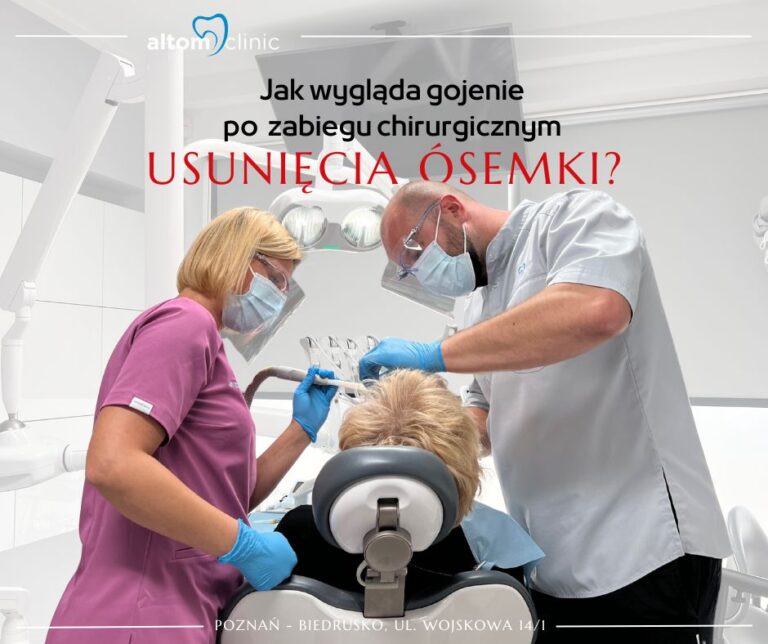 Jak wygląda gojenie po zabiegu chirurgicznym usunięcia ósemki?