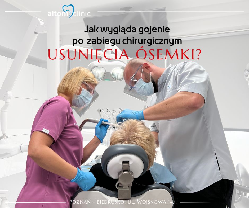 Jak wygląda gojenie po zabiegu chirurgicznym usunięcia ósemki?