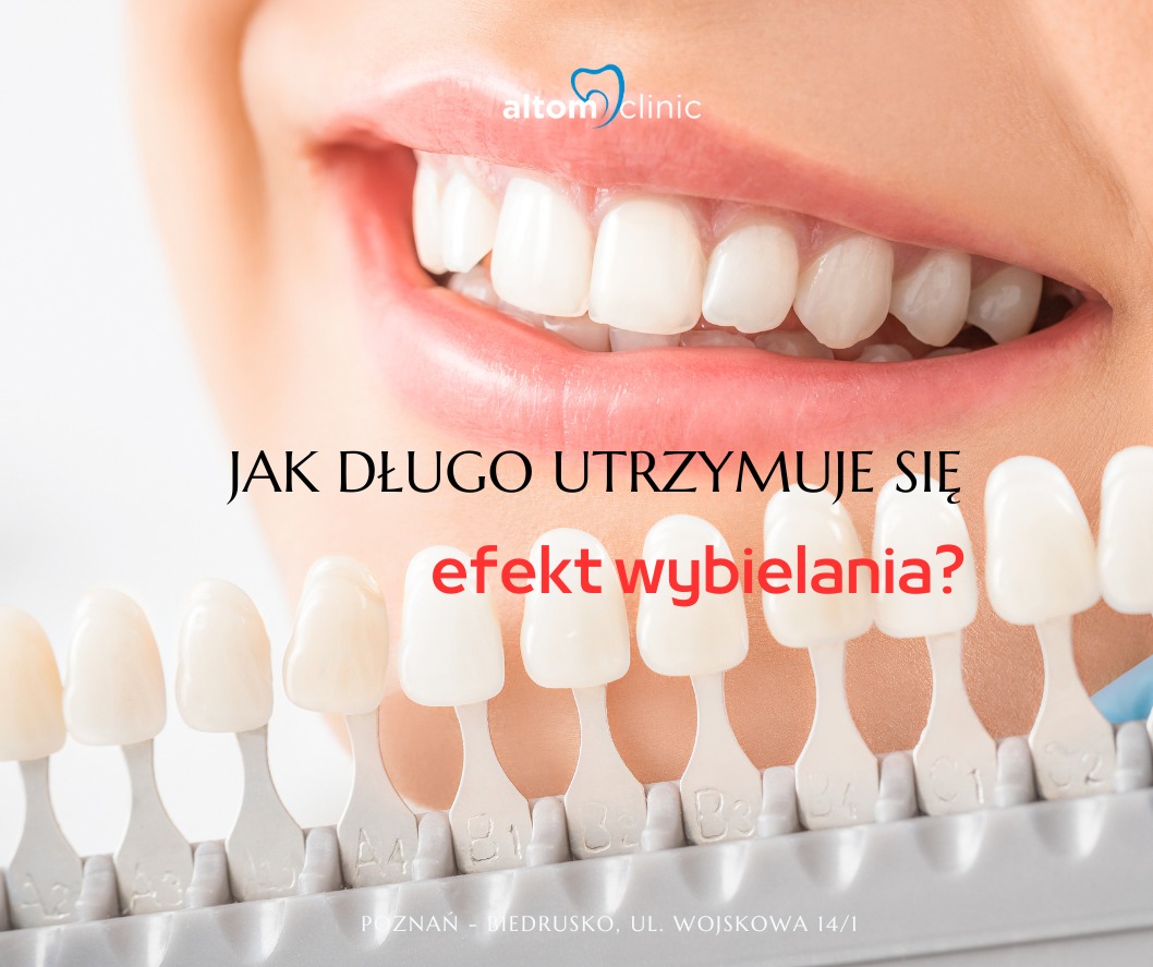 Jak długo utrzymuje się efekt wybielania?