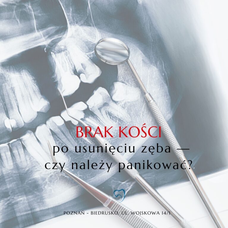 Brak kości po usunięciu zęba — czy należy się martwić?