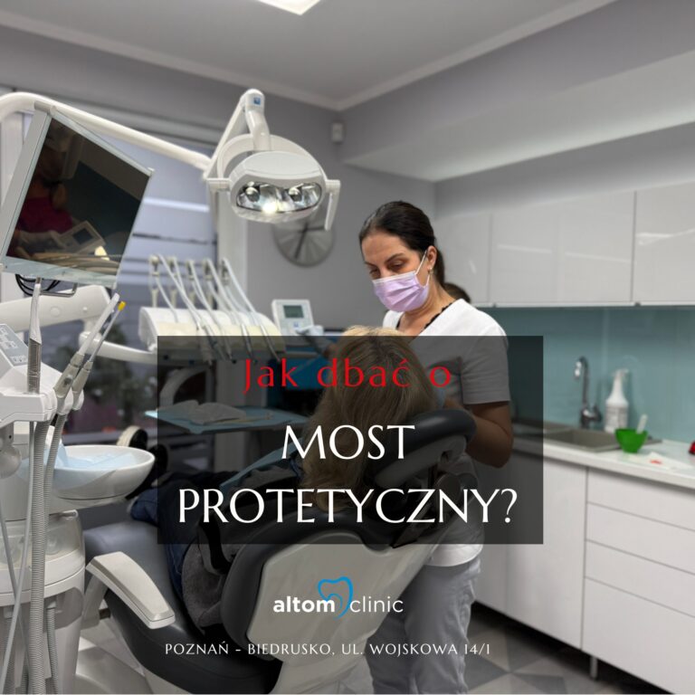 Jak dbać o most protetyczny?