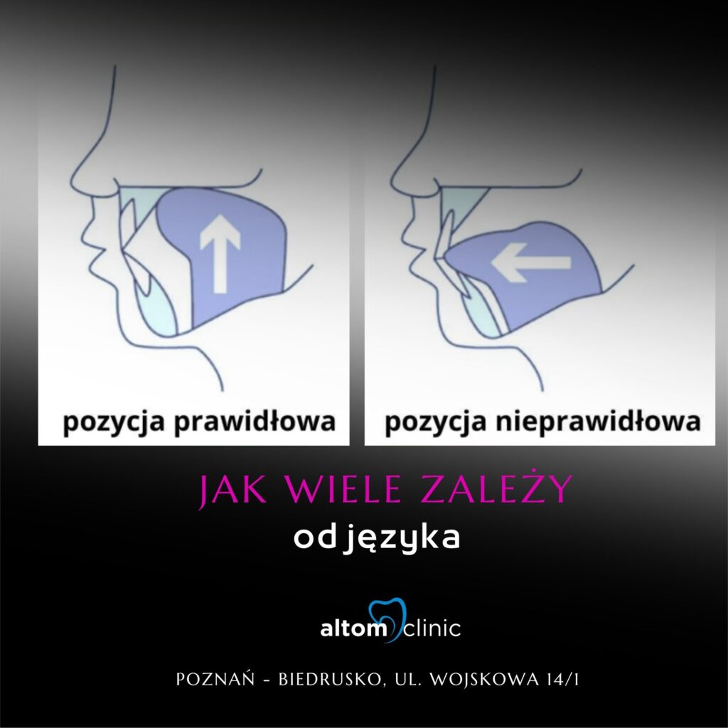 Czy wiesz, że porównując stosunek siły do wielkości, język to najsilniejszy mięsień w naszym ciele Poznań
