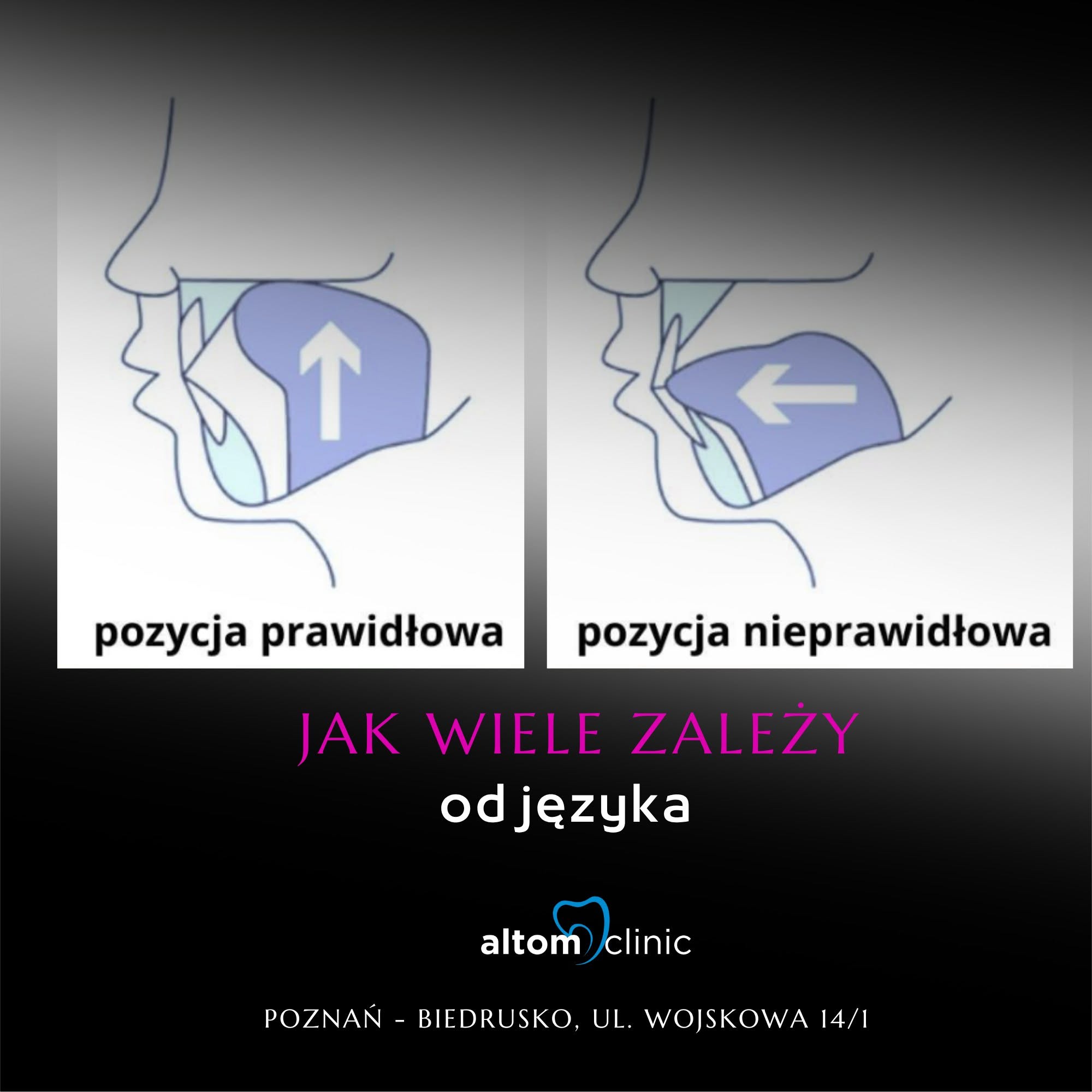 Czy wiesz, że porównując stosunek siły do wielkości, język to najsilniejszy mięsień w naszym ciele Poznań