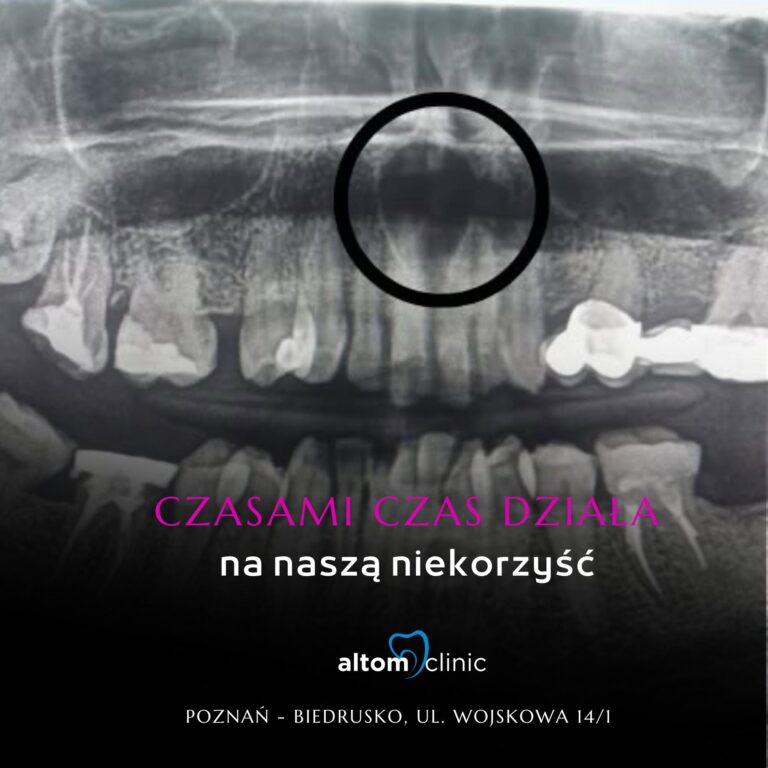 Mówisz Mam czas niedawno robiłem przegląd w końcu nic mnie nie boli Poznań