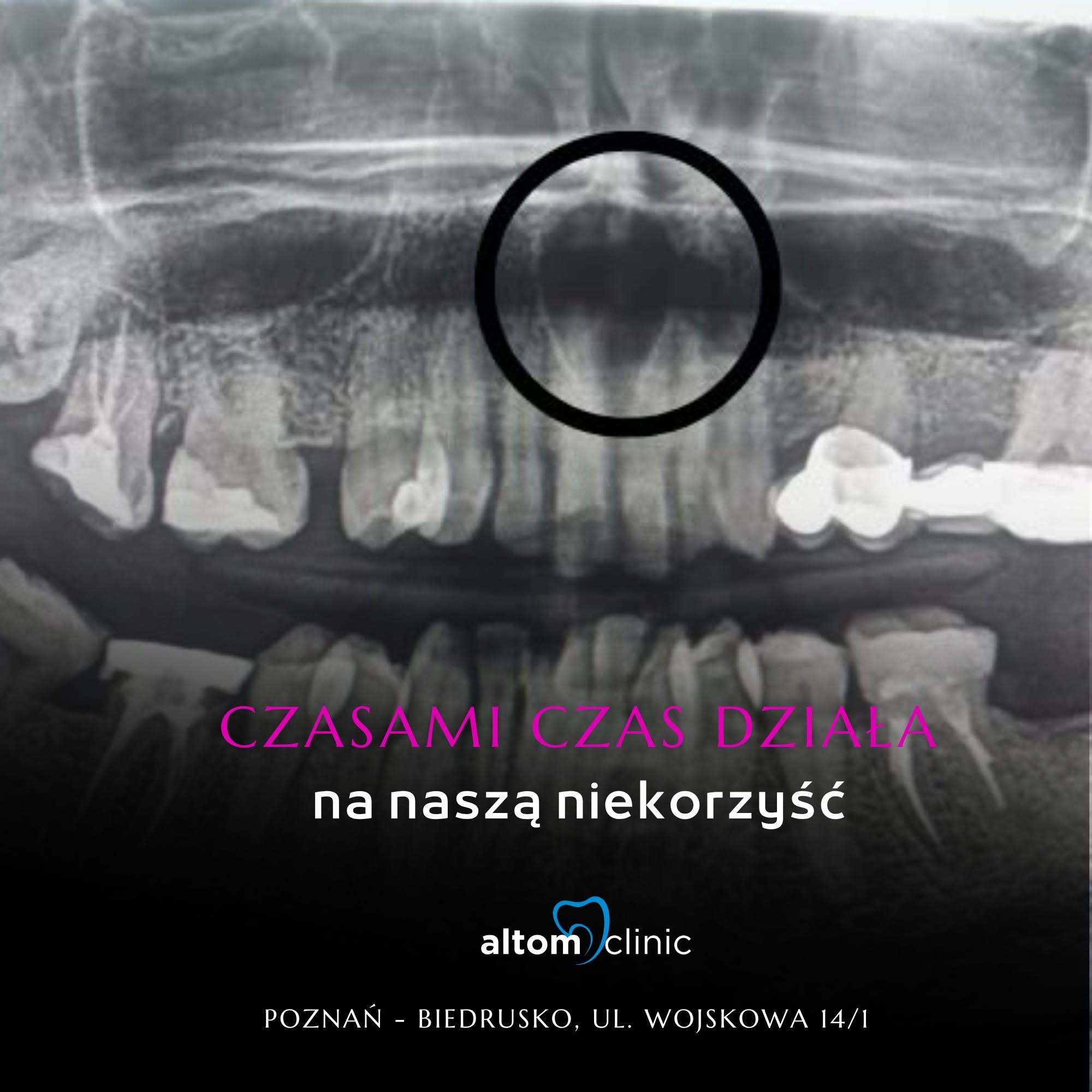 Mówisz Mam czas niedawno robiłem przegląd w końcu nic mnie nie boli Poznań