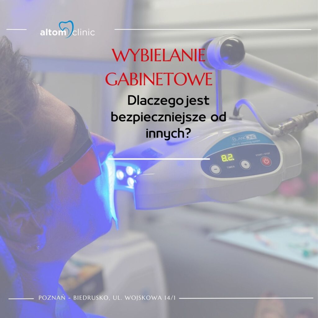 Wybielanie gabinetowe – dlaczego jest bezpieczniejsze Poznań
