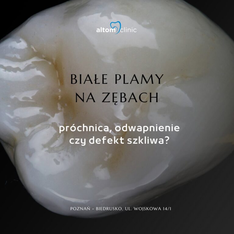 Białe plamy na zębach? Poznaj przyczyny